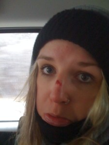 Poor Sophie's face : (